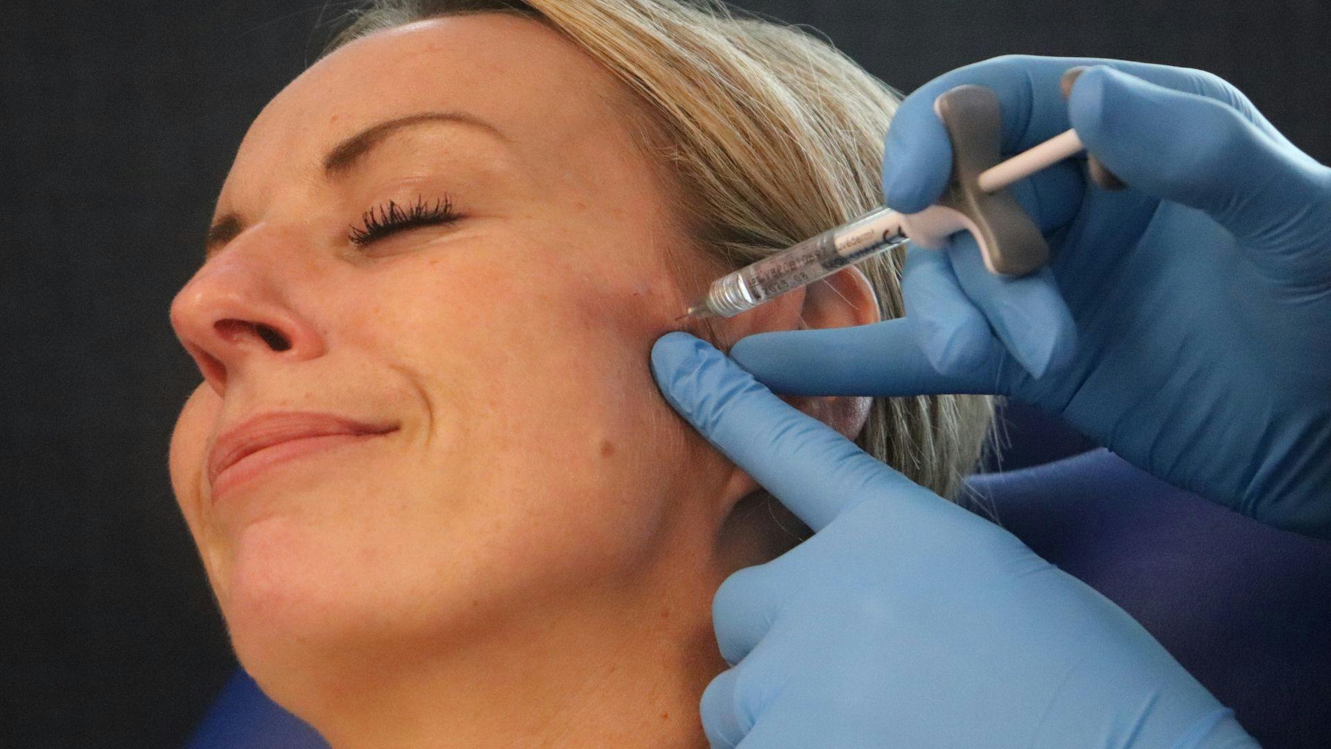 Cheek filler treatment at Harley Academy