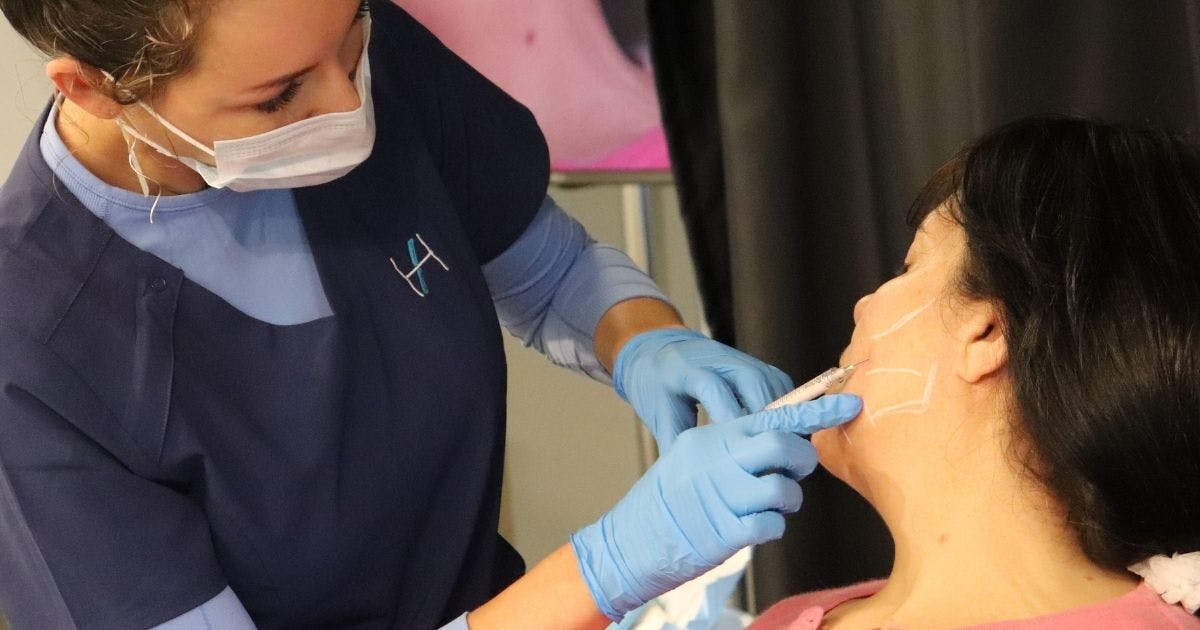 Collagen-stimulating CaHA fillers calcium hydroxlapatite