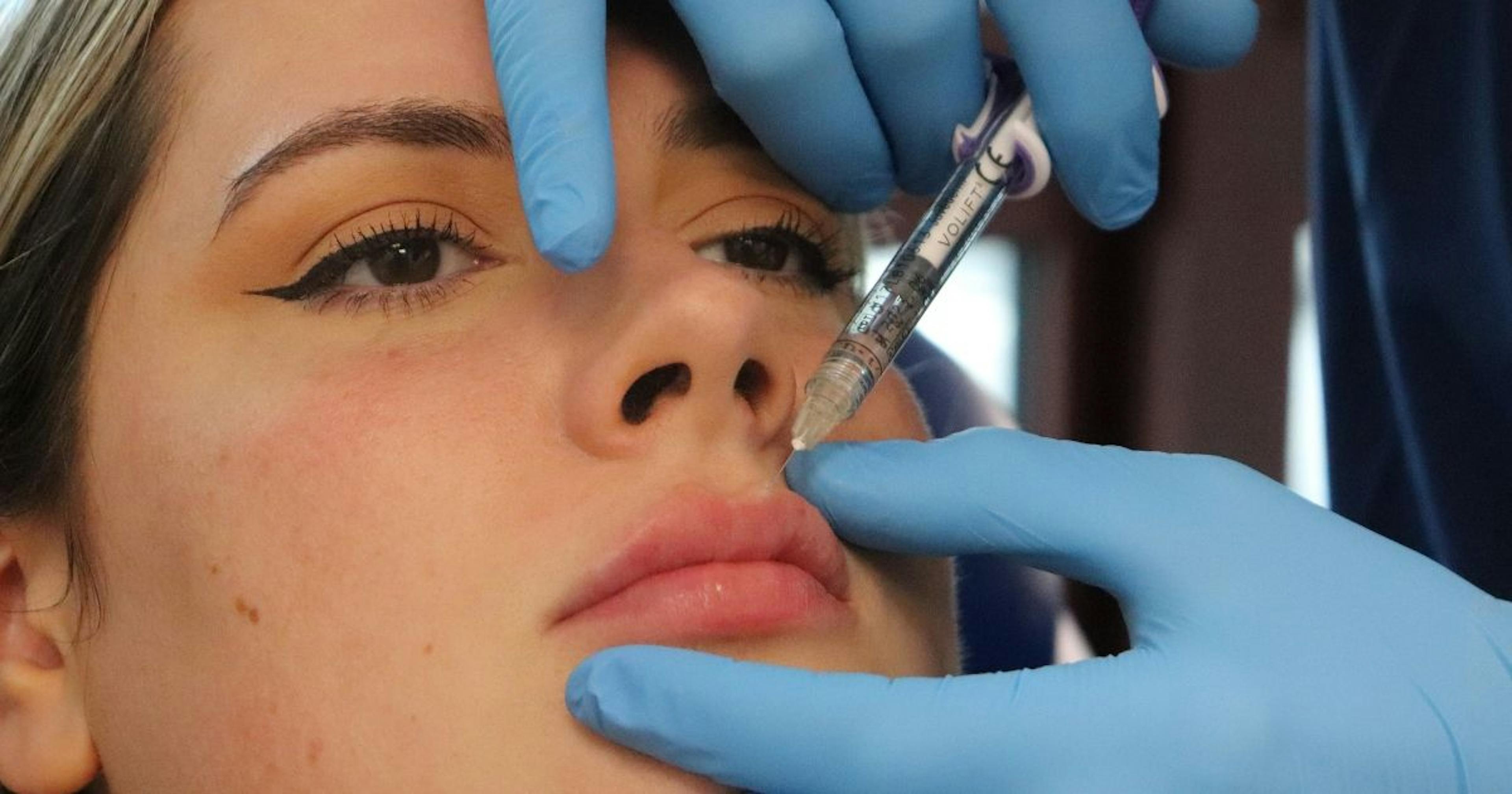 How to Inject Lip Filler Safely and Effectively