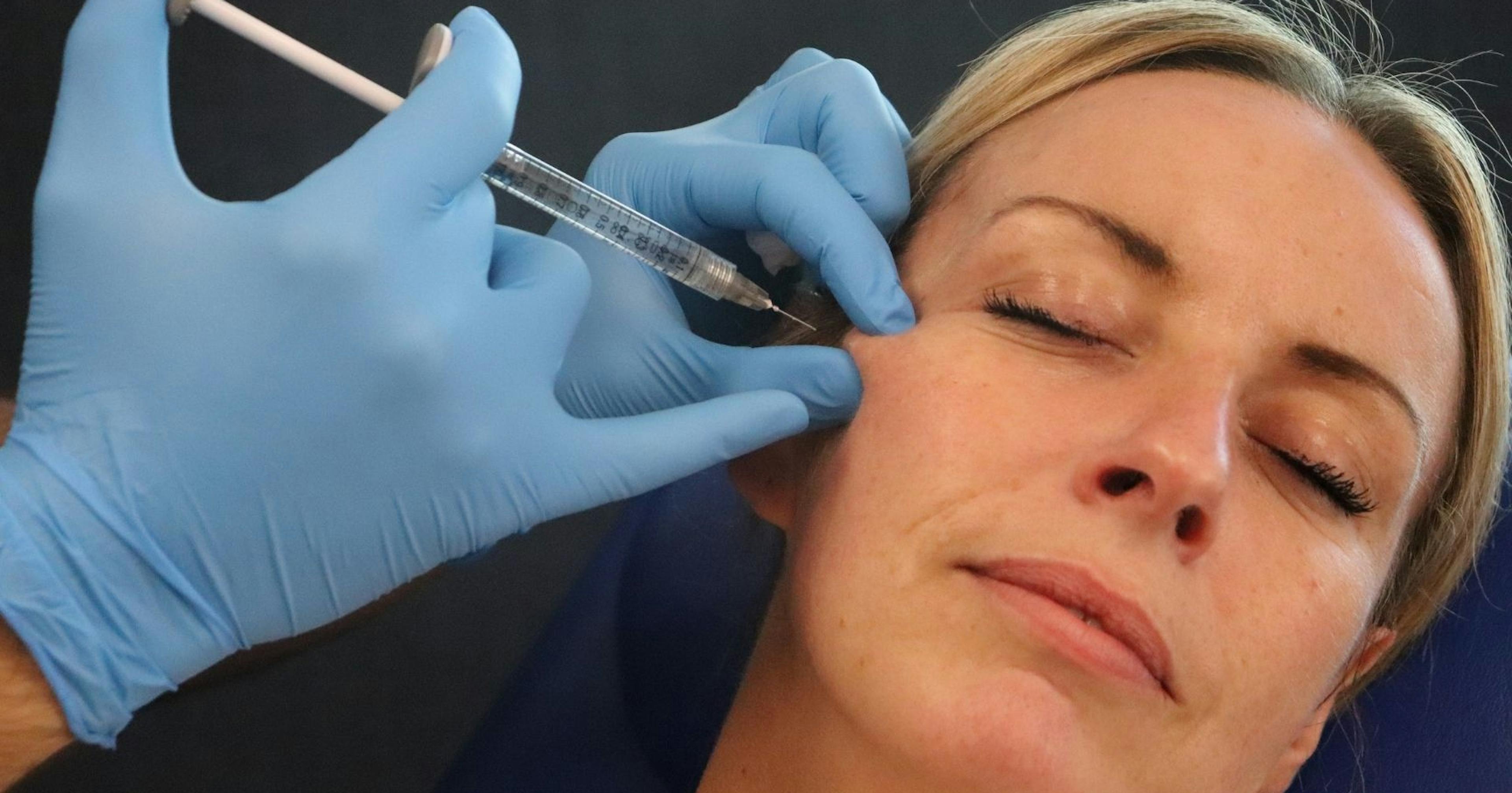 TOP BOX Cheek Filler Techniques