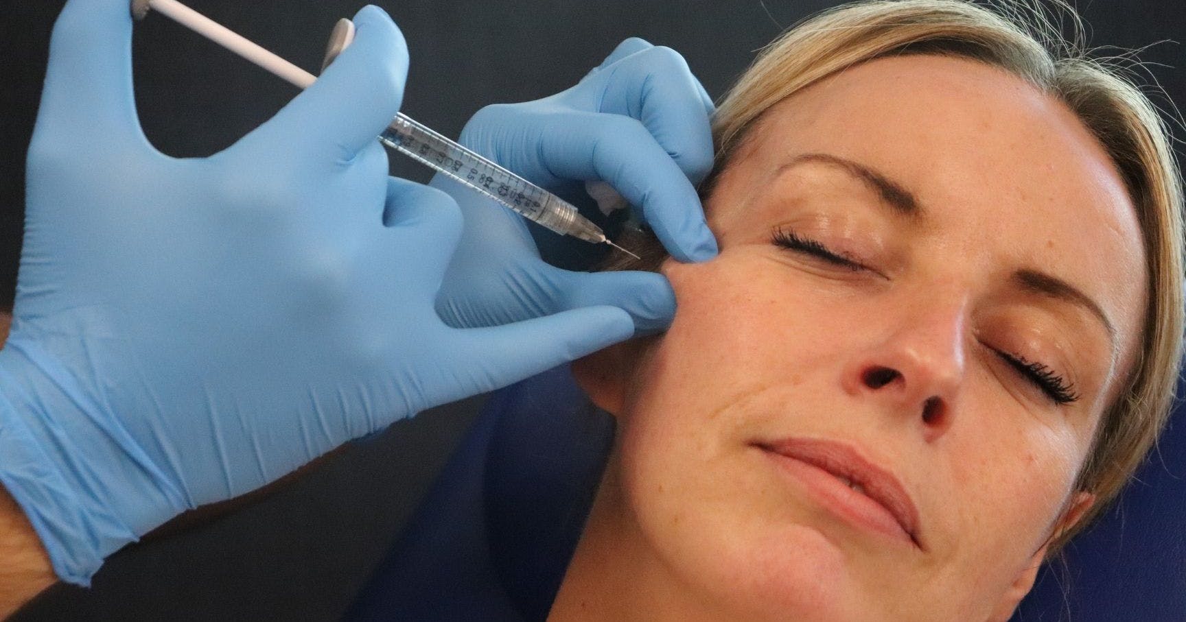TOP BOX Cheek Filler Techniques