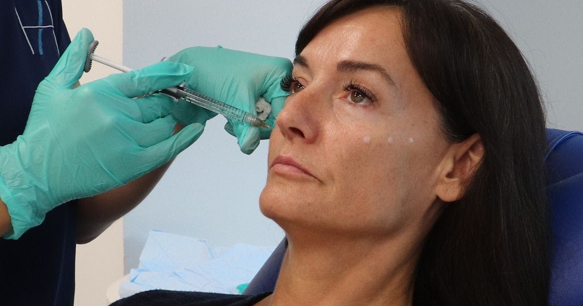 Safe Cheek Filler injection techniques