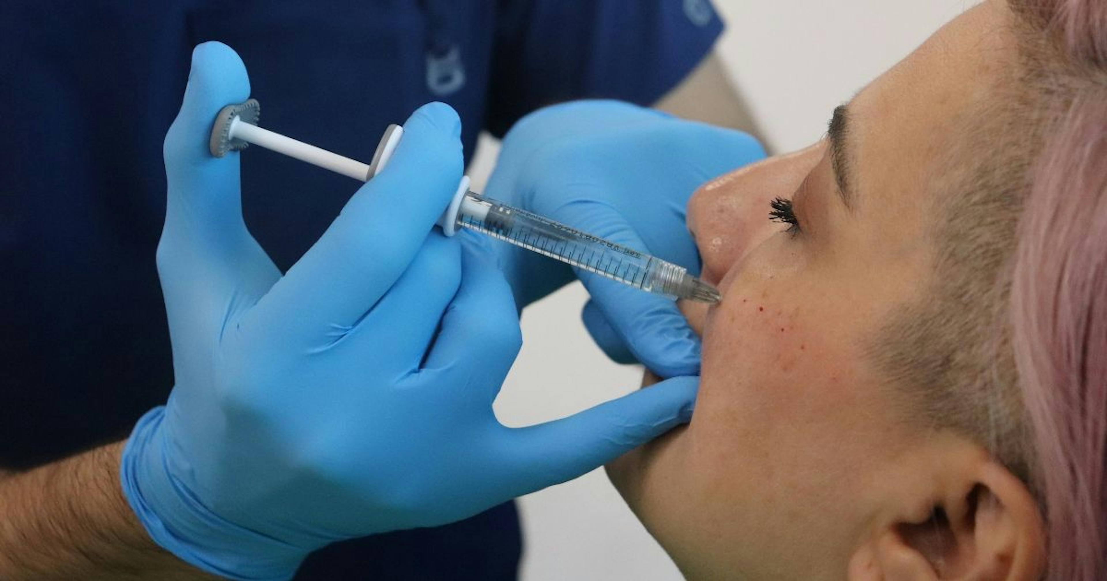 Safe cheek filler injection techniques lateral medial