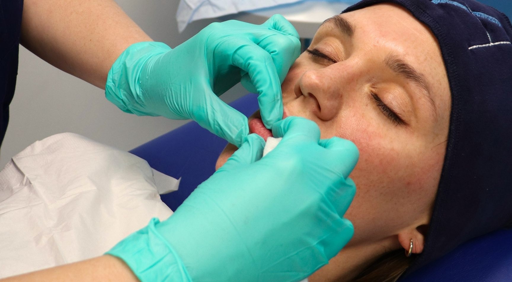 TOP BOX Improve Lip Filler Results with Massage Techniques