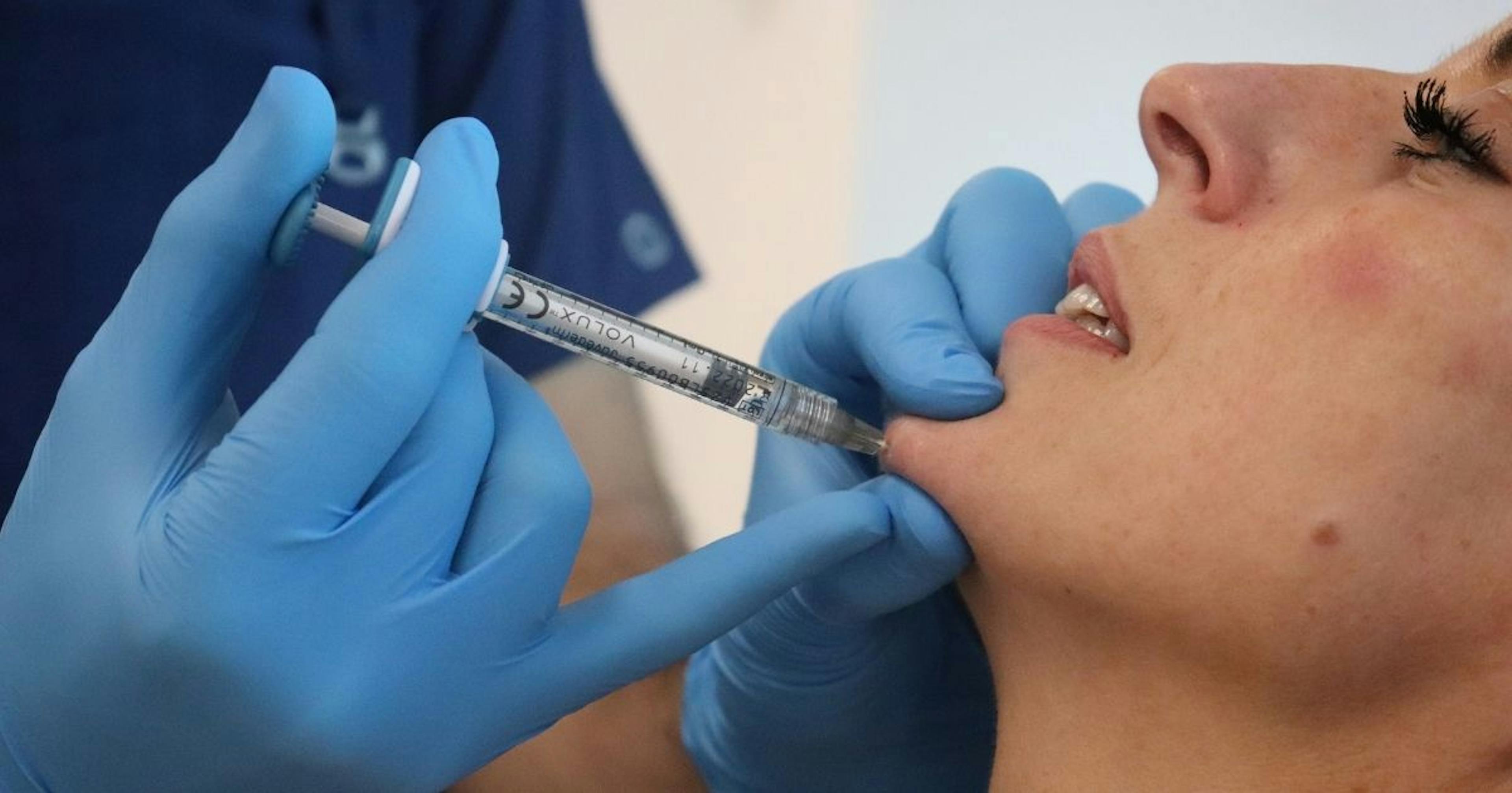 A patient receiving a chin filler injection 