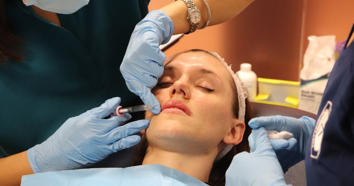 How to Inject Lip Filler When a Scar is Present