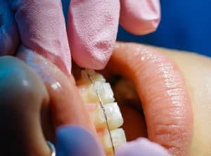 Aesthetic Medicine Training for denitists