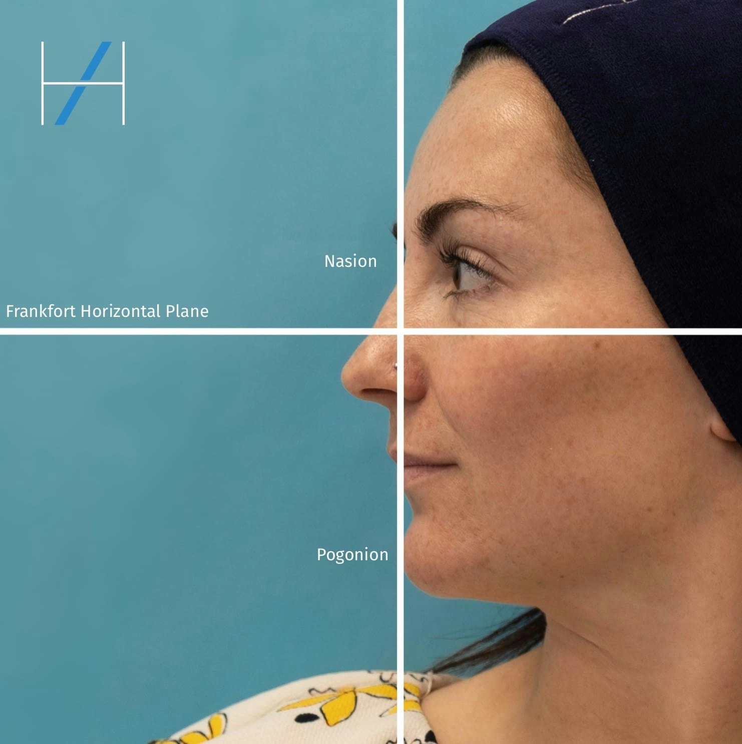 How To Assess The Chin And Lower Face