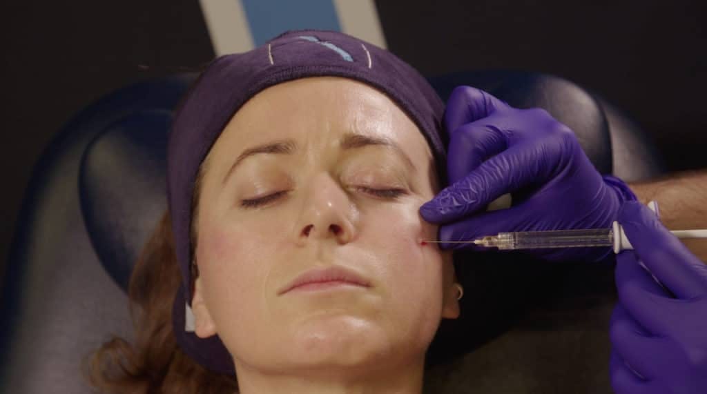Midface treatment