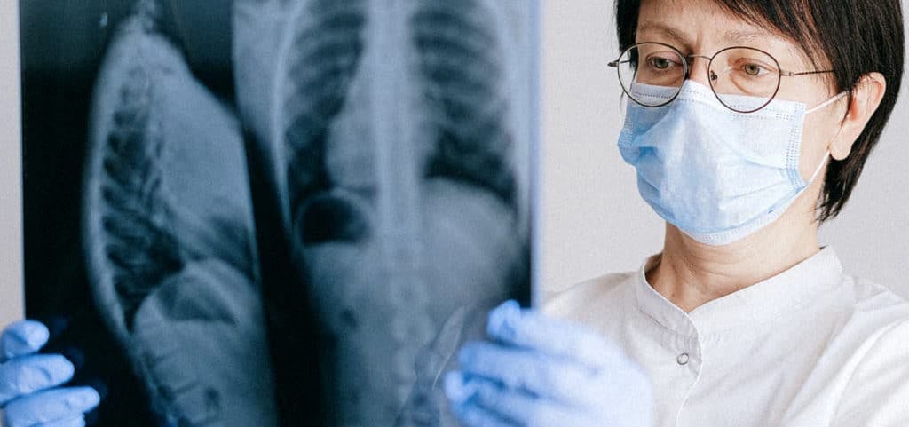 Health Complications Associated with COVID