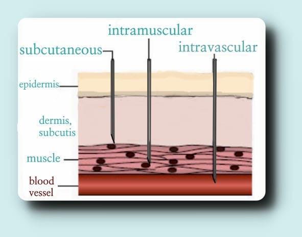 Injection Diagram