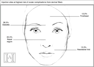 Diagram fillers risk