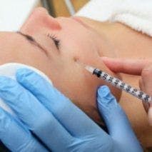 Dermal filler blindness