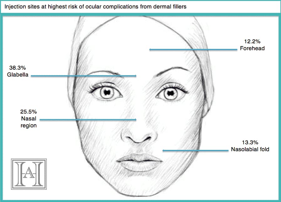 Diagram fillers risk 2