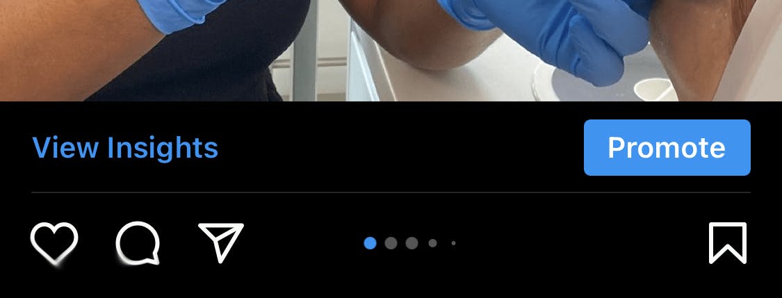 Aesthetics Marketing Social Media for Injectors Instagram Insights