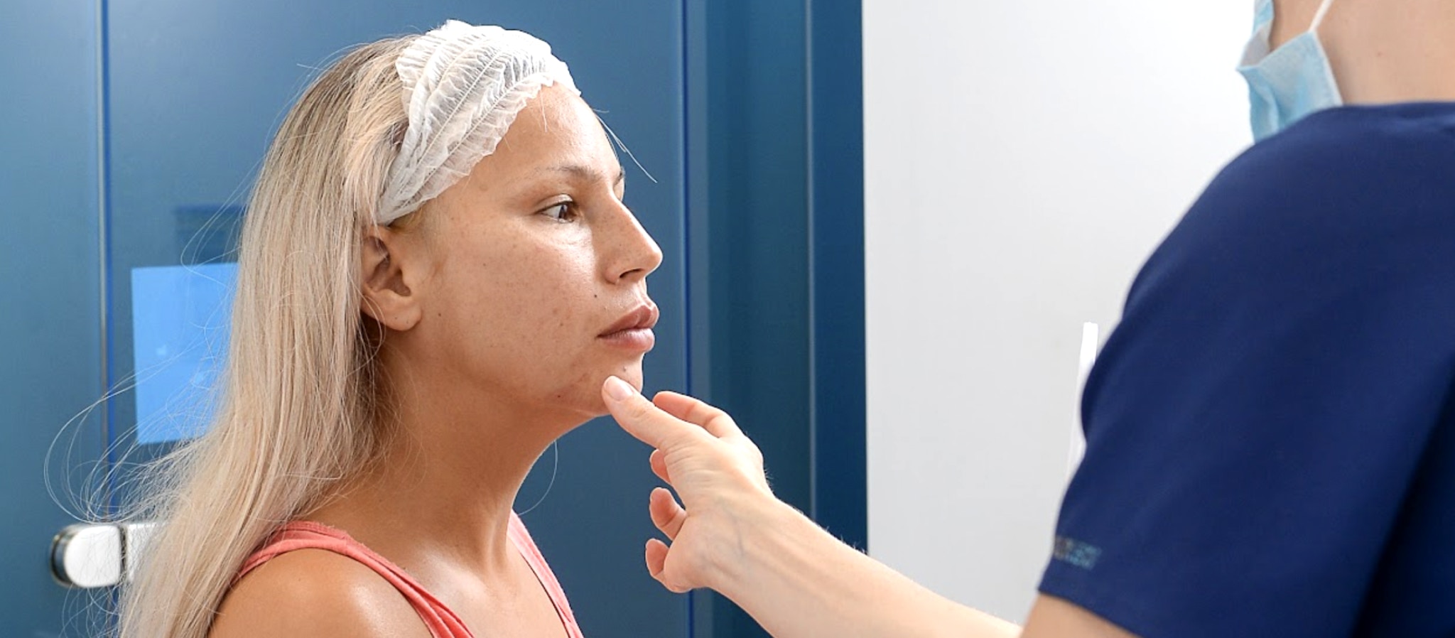 Identifying lip filler migration new aesthetics practitioners