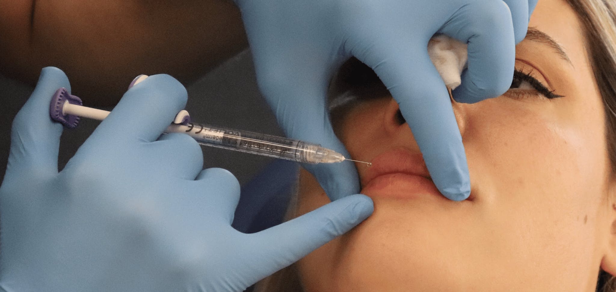 Dissolving Lip Filler Using Hyaluronidase | Harley Academy