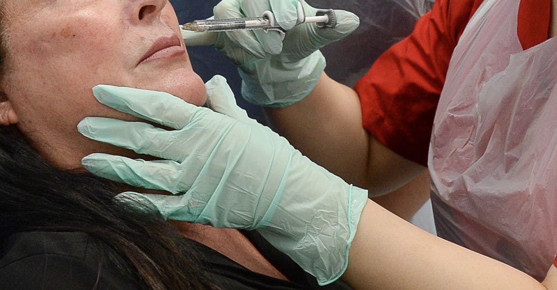 Non Surgical Facial Feminisation Injectable Treatments Aesthetics