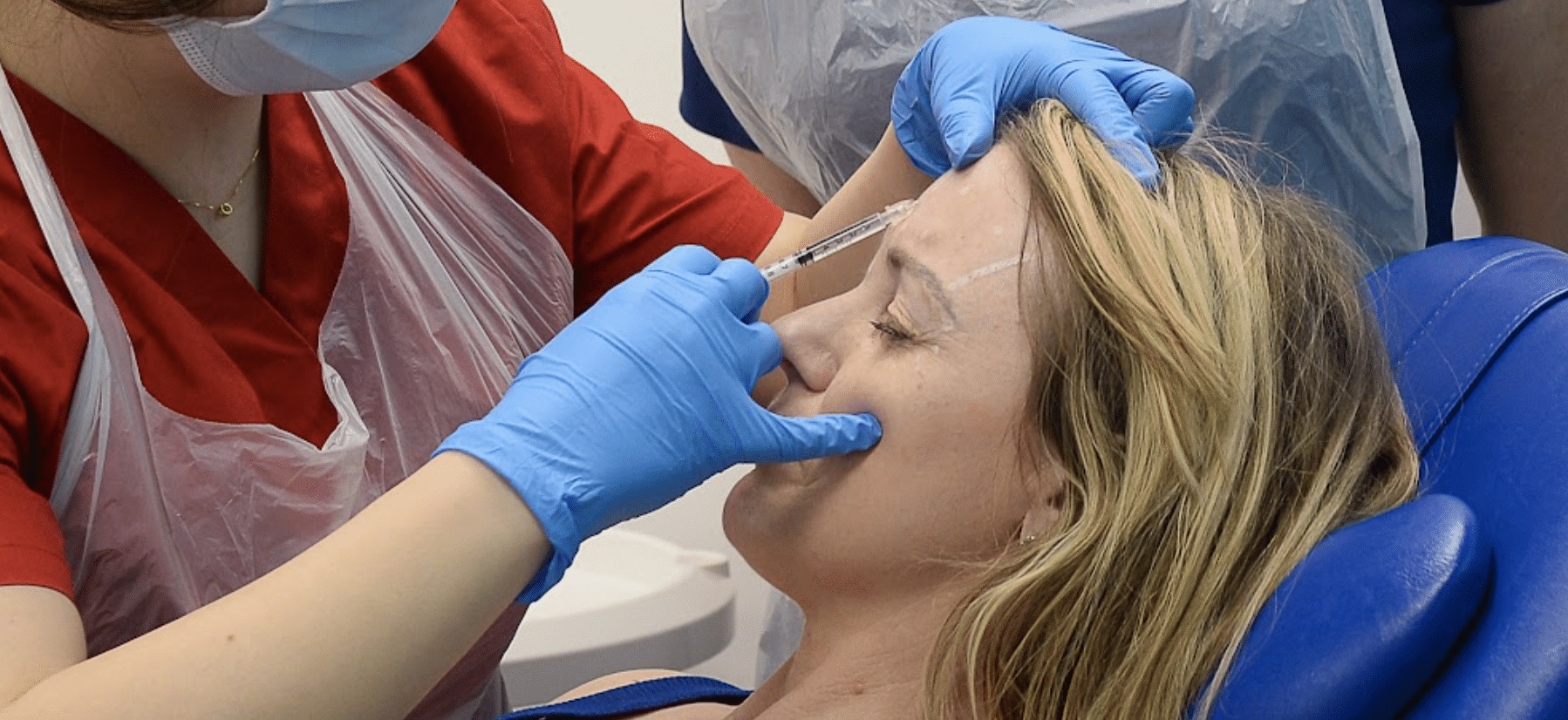 Botulinum toxin upper face aesthetic treatment