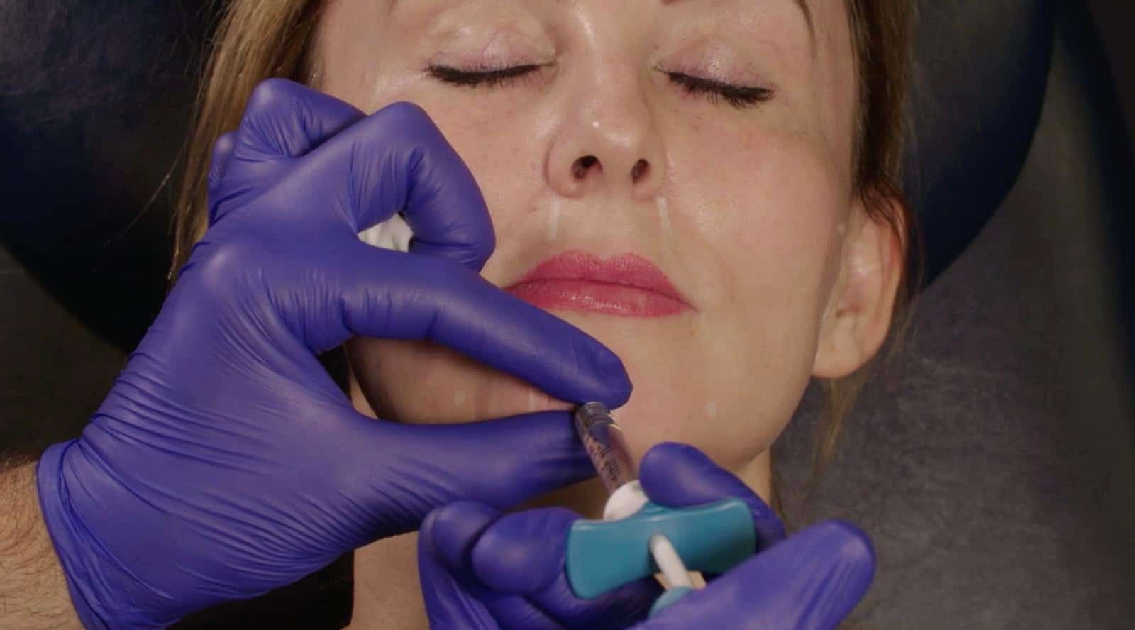 How To Prevent Lumps From Filler | Harley Academy