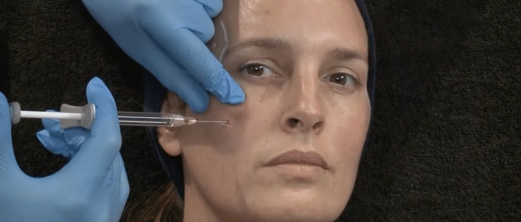 Dr Tristan Mehta Full Face Dermal Fillers Demonstration video