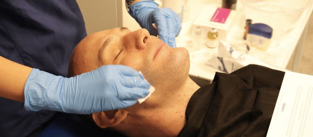 chemical peel training course cosderm cosmetic dermatology