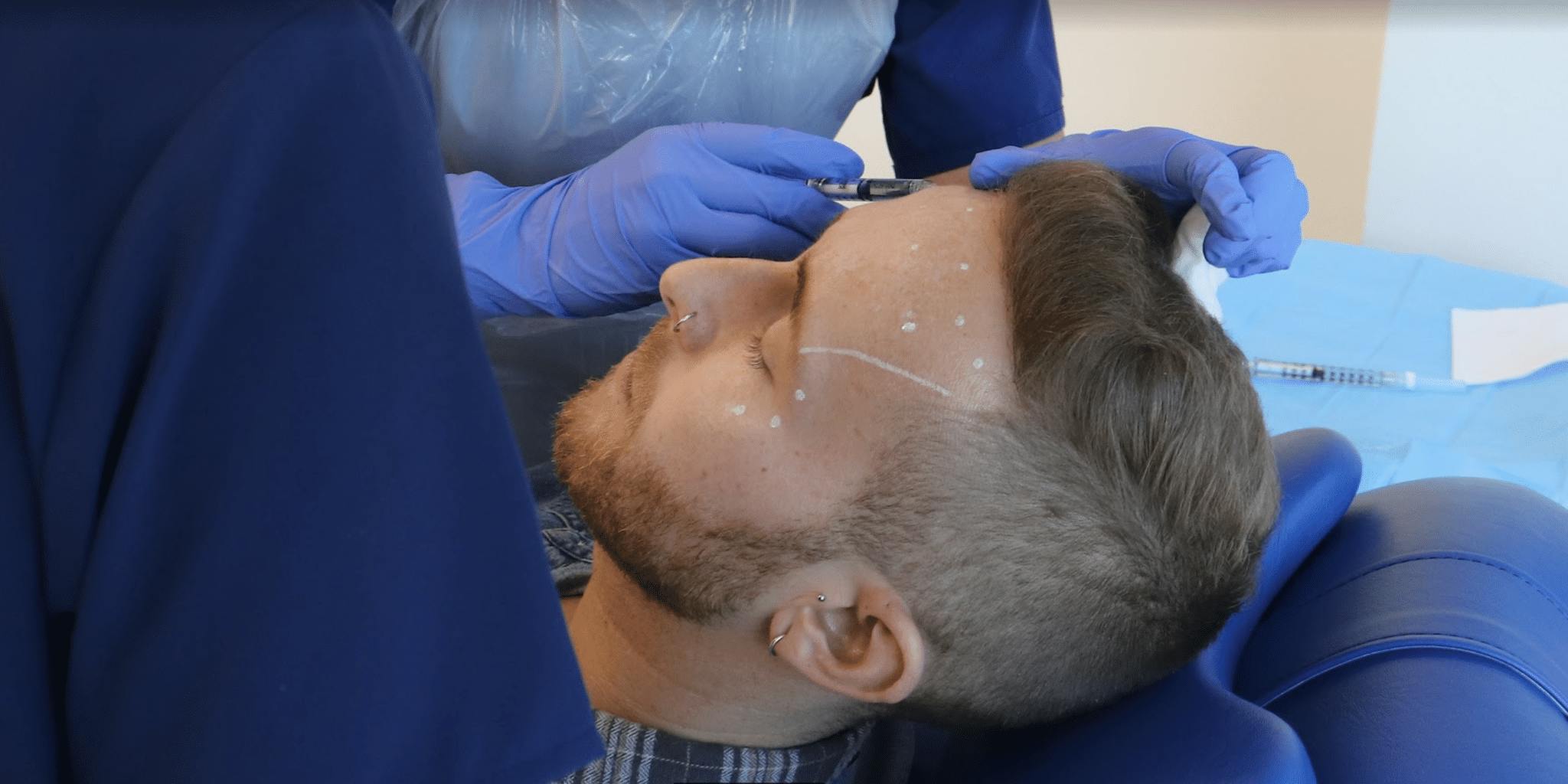 Administering Botox to Male Patients