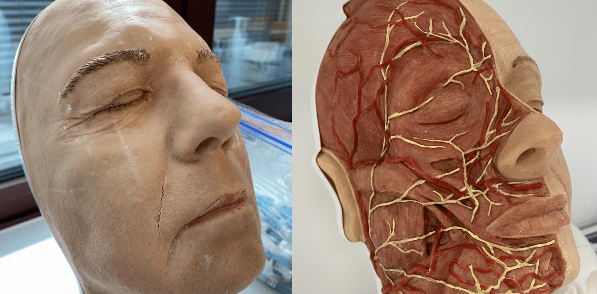 Learning dermal fillers for male patients