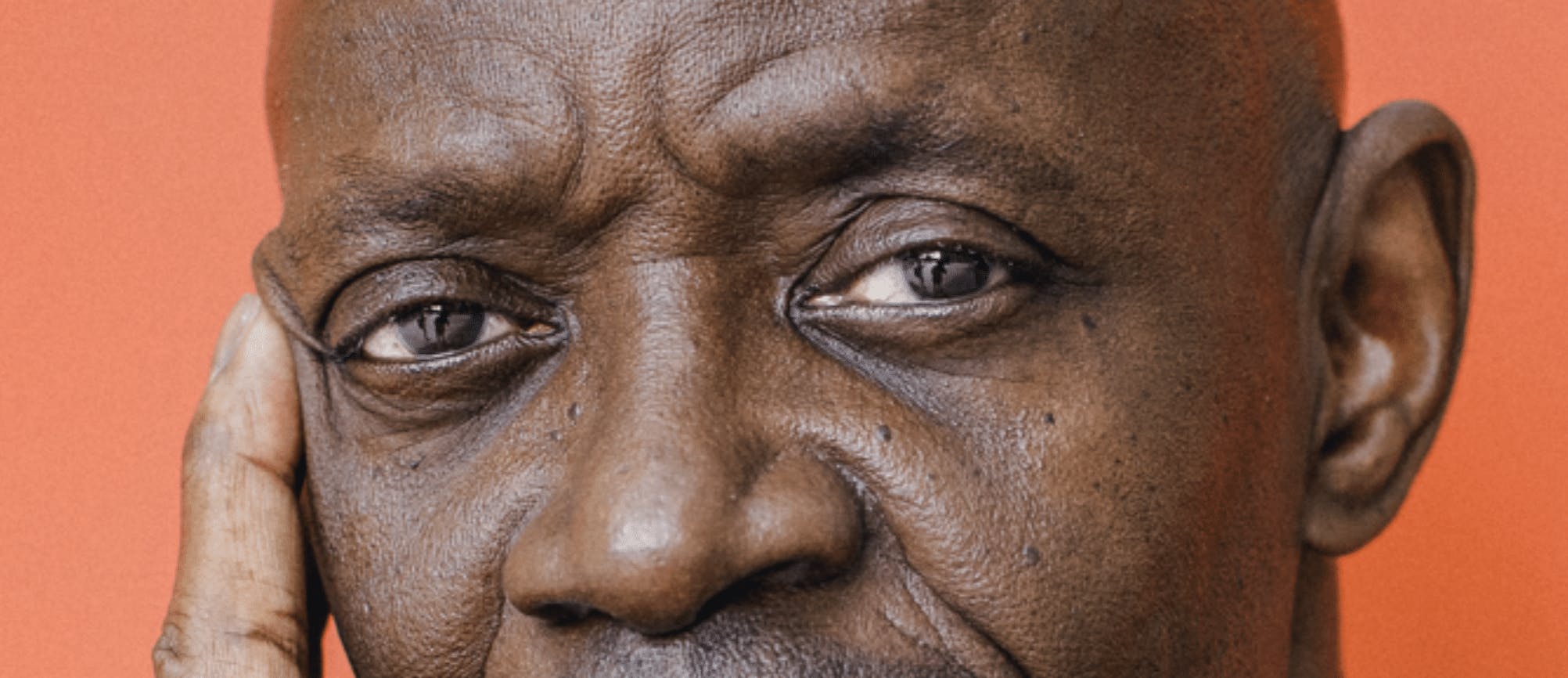 Treating Patients Under Eye Concerns dark circles