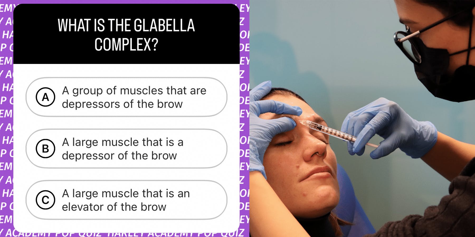What is the glabella complex