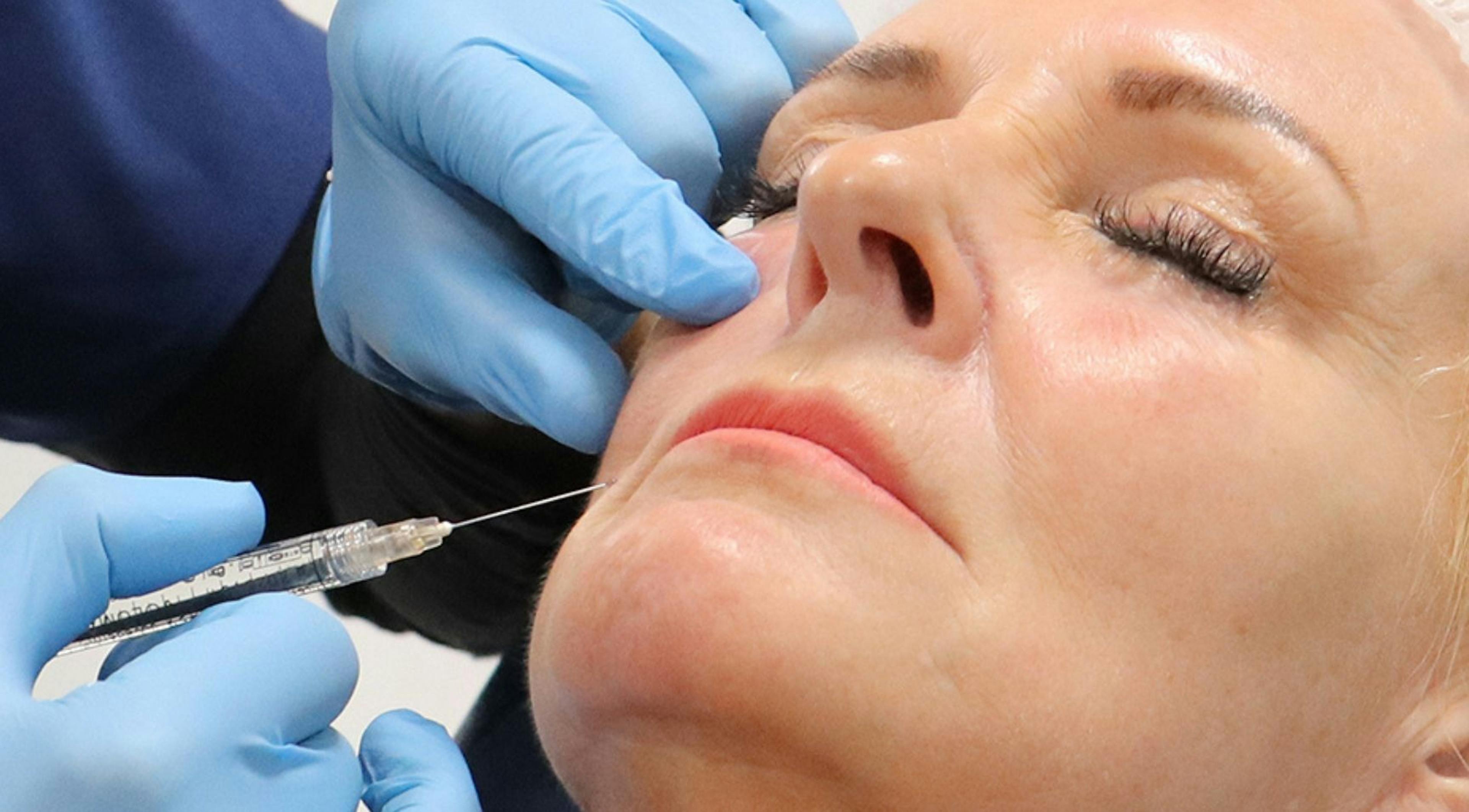 Patient receiving Revanesse®: Mid-Face & Cannula injectable treatment
