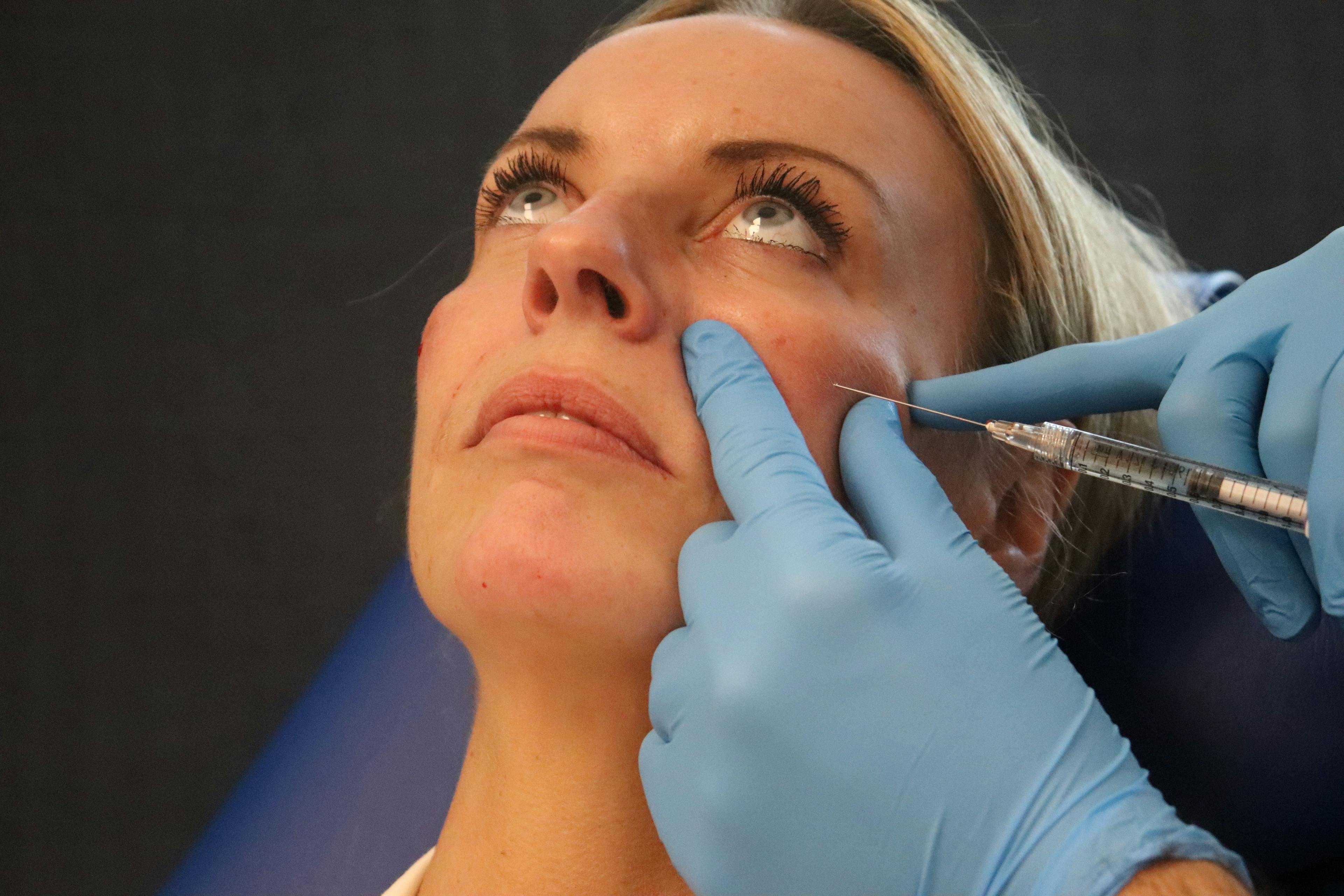 Cheek filler demonstration during a Level 7 Diploma in Botox & Dermal Fillers Observation Day at Harley Academy
