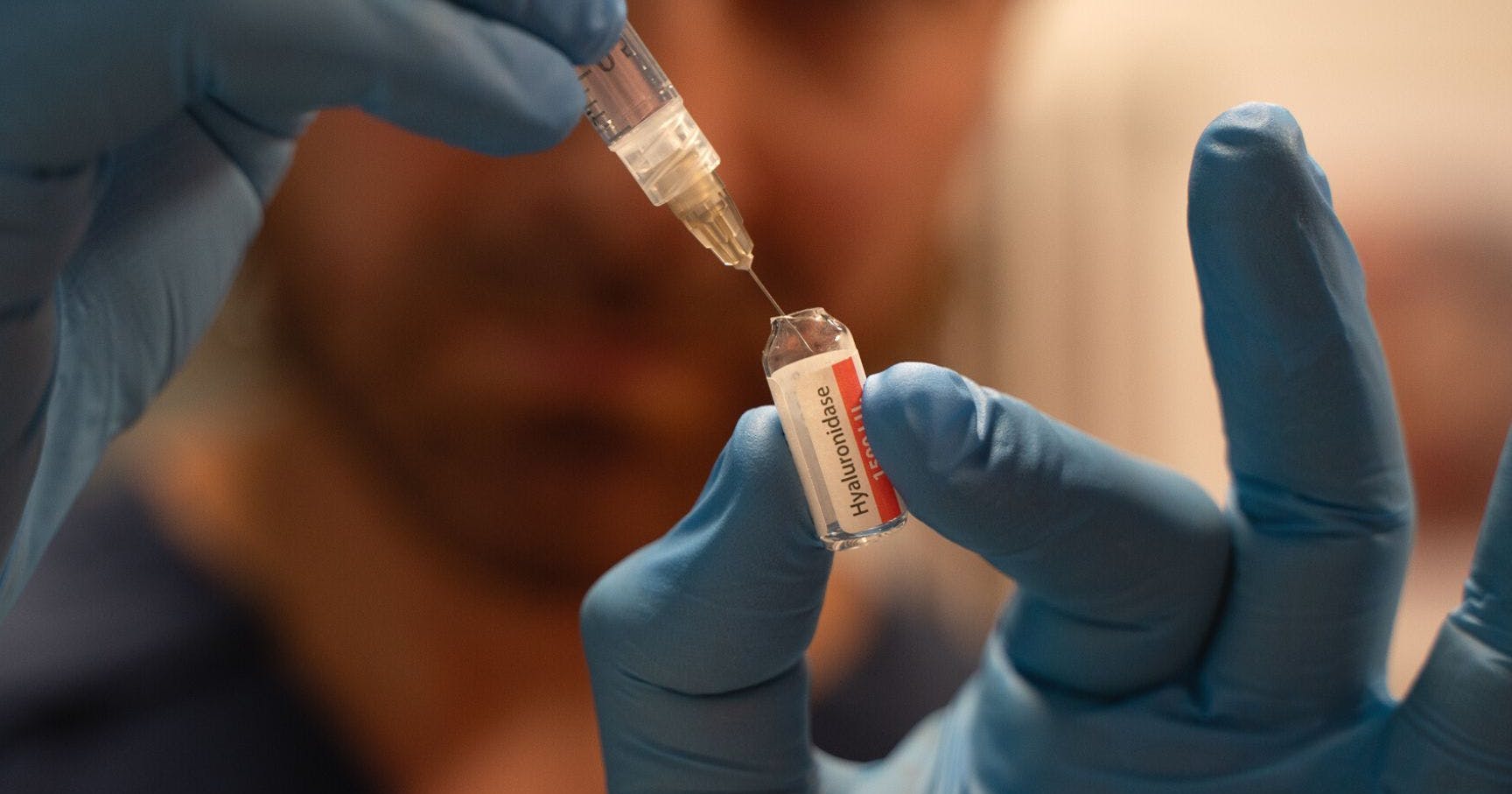 Preventing and Managing dermal filler complications including dissolving