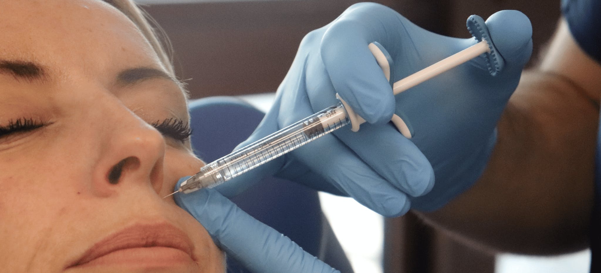 Injecting the piriform fossa nasolabial fold