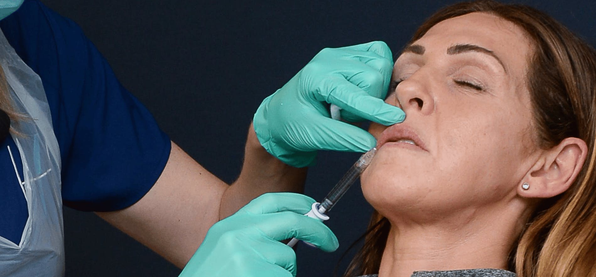 Lip Filler Techniques for Mature Patients