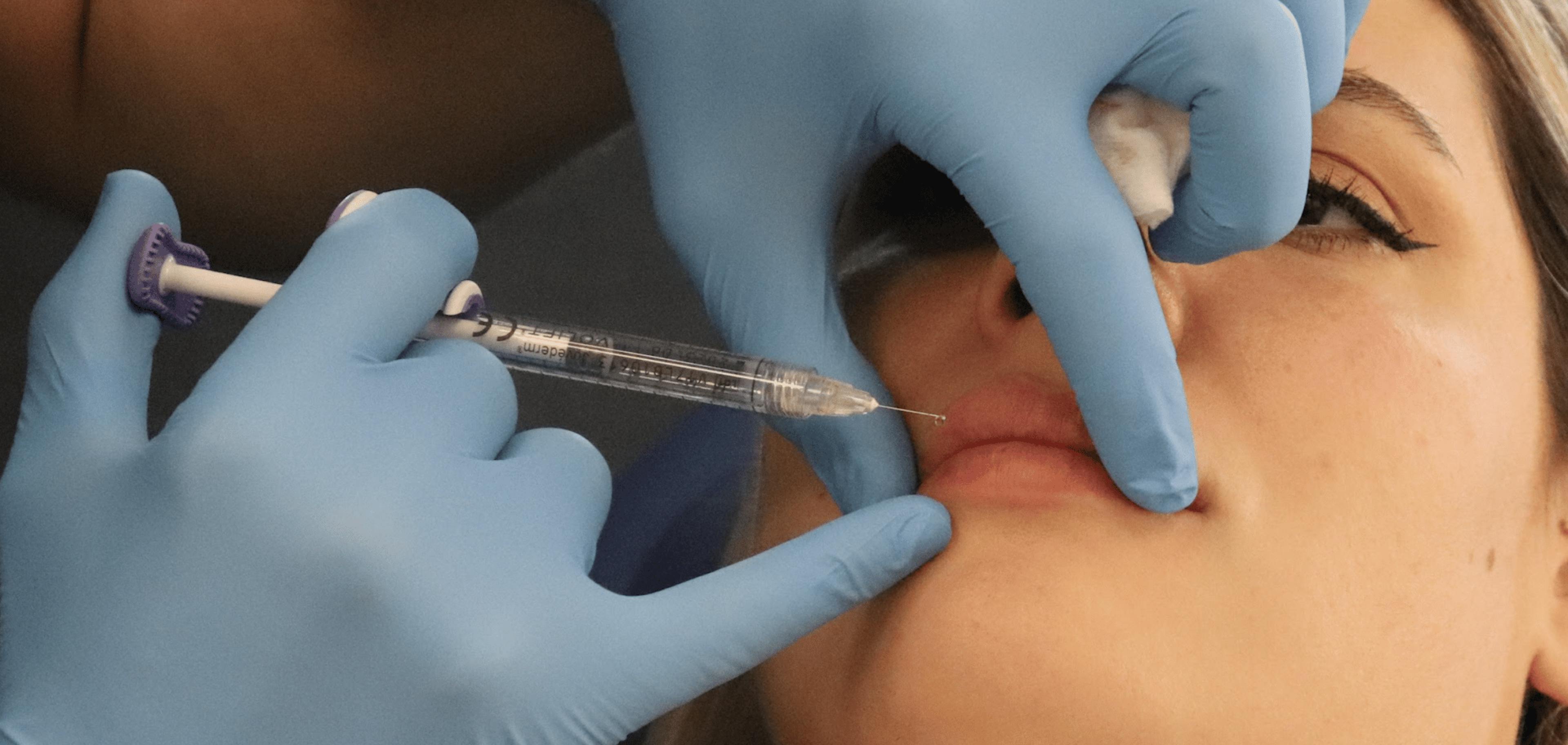 How to inject the cupids bow lip filler courses at Harley Academy