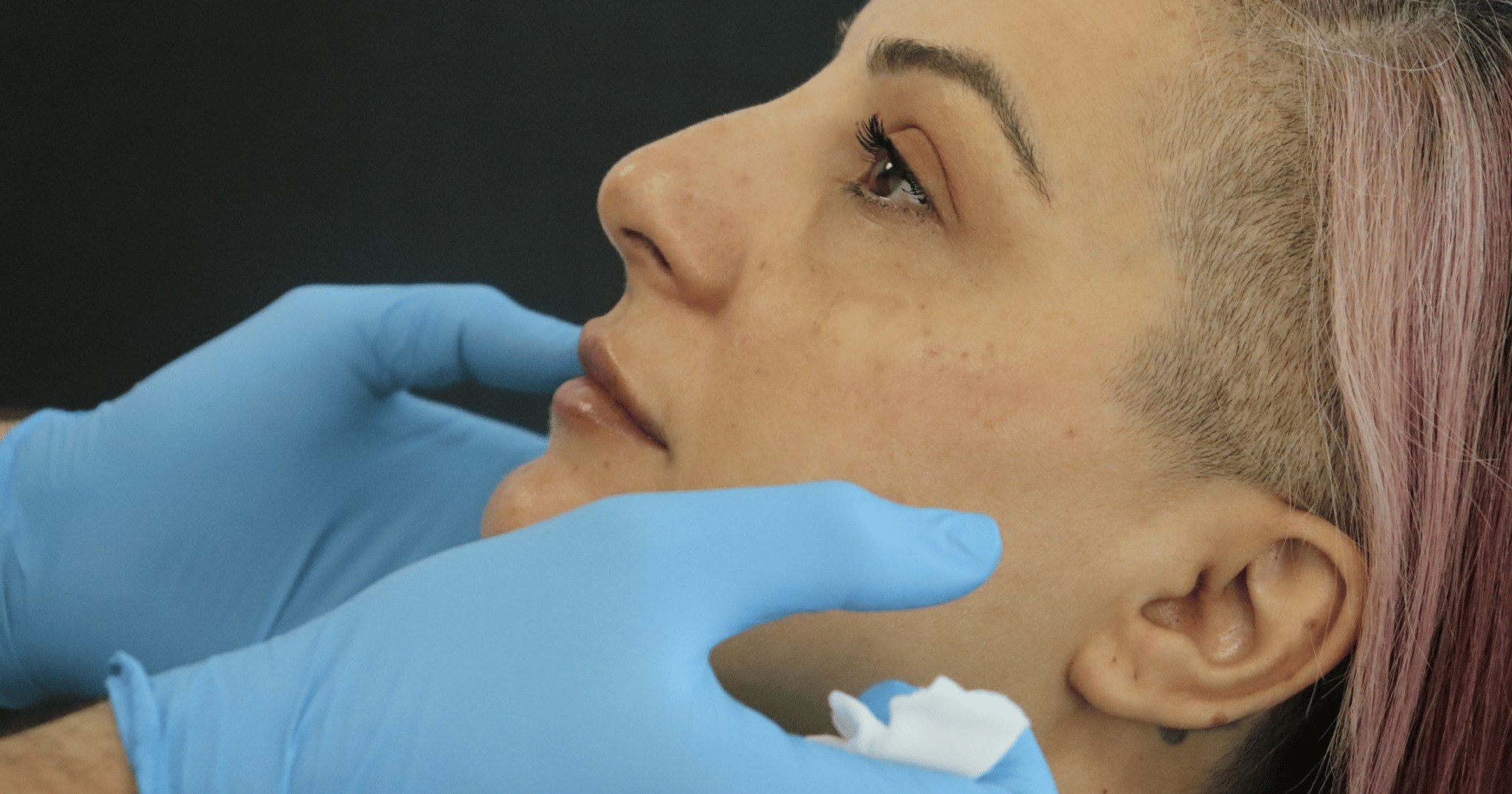 Palpable Filler