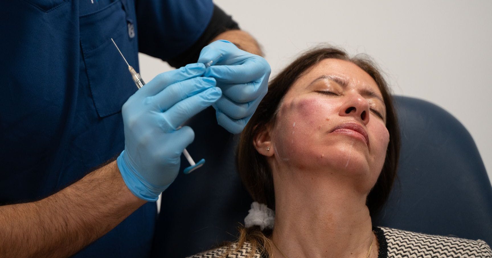 Preparing Cheek Filler Patient for Cannula Treatment Harley Academy Medical Aesthetics Training Courses for Doctors Dentists Nurses Level 7 Injectables London