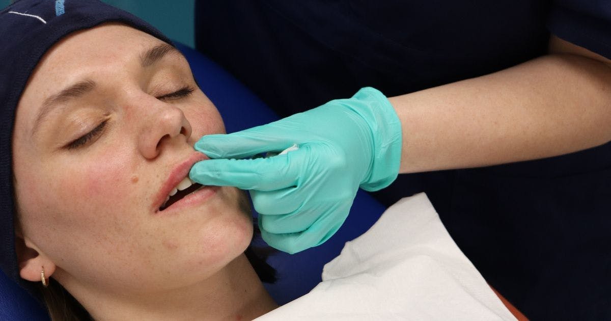 Lip Filler techniques massage to avoid lumps