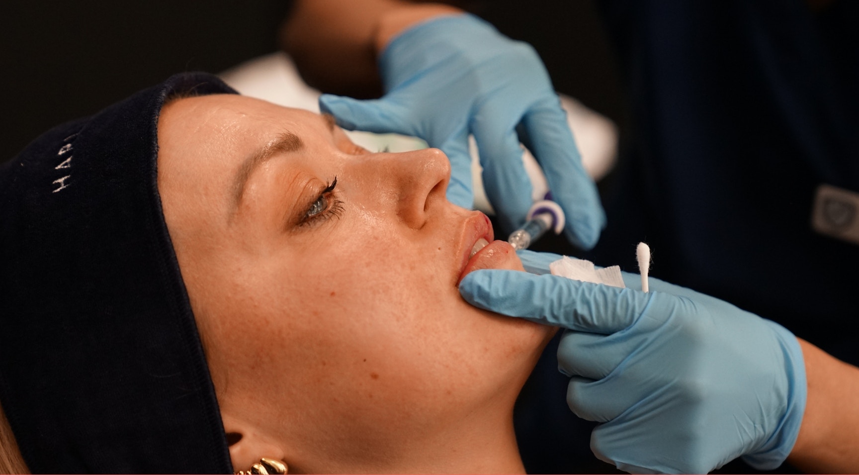 How to Produce Safe, Natural-Looking Lip Filler Results - Harley Academy 