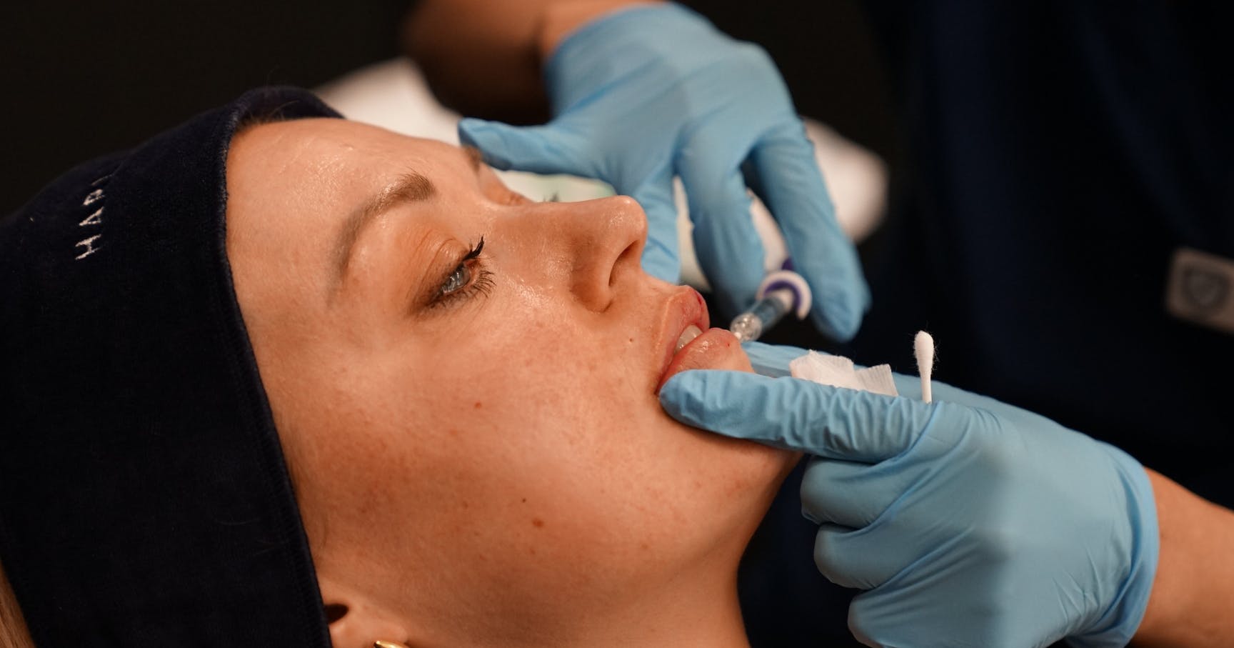 How to Produce Safe, Natural-Looking Lip Filler Results - Harley Academy 