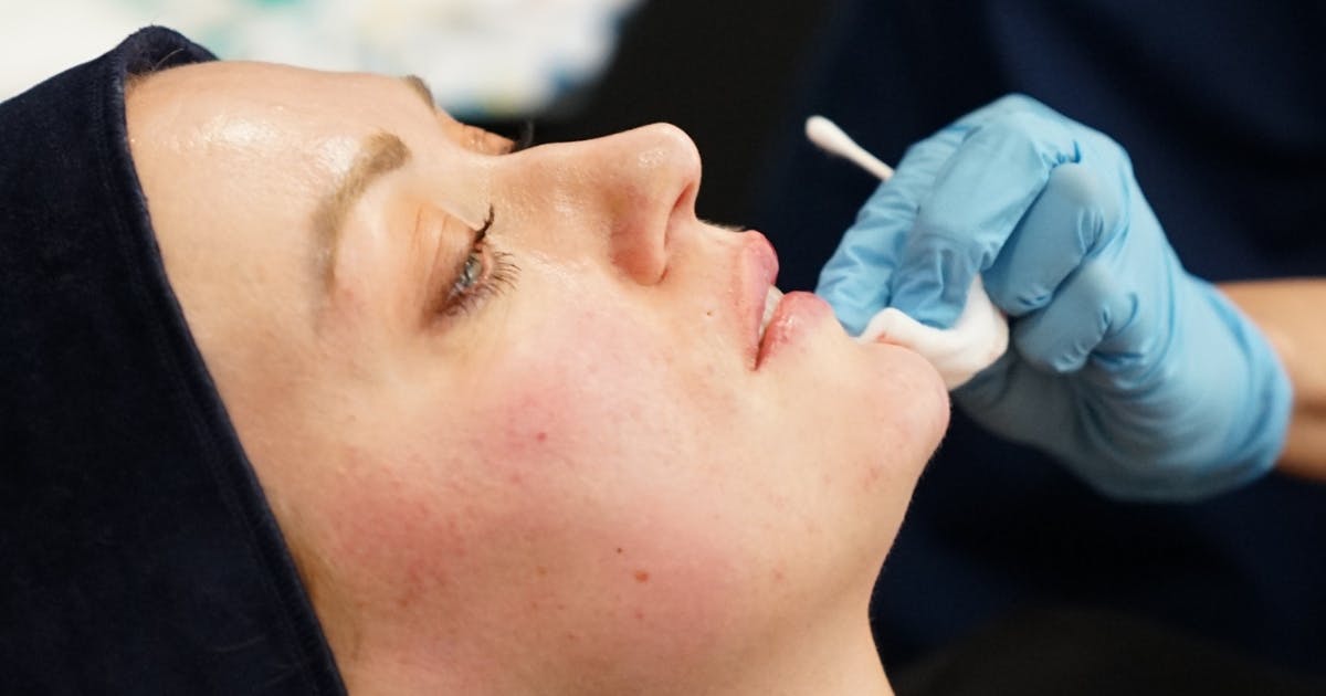 Safe Natural-Looking Lip Filler course London