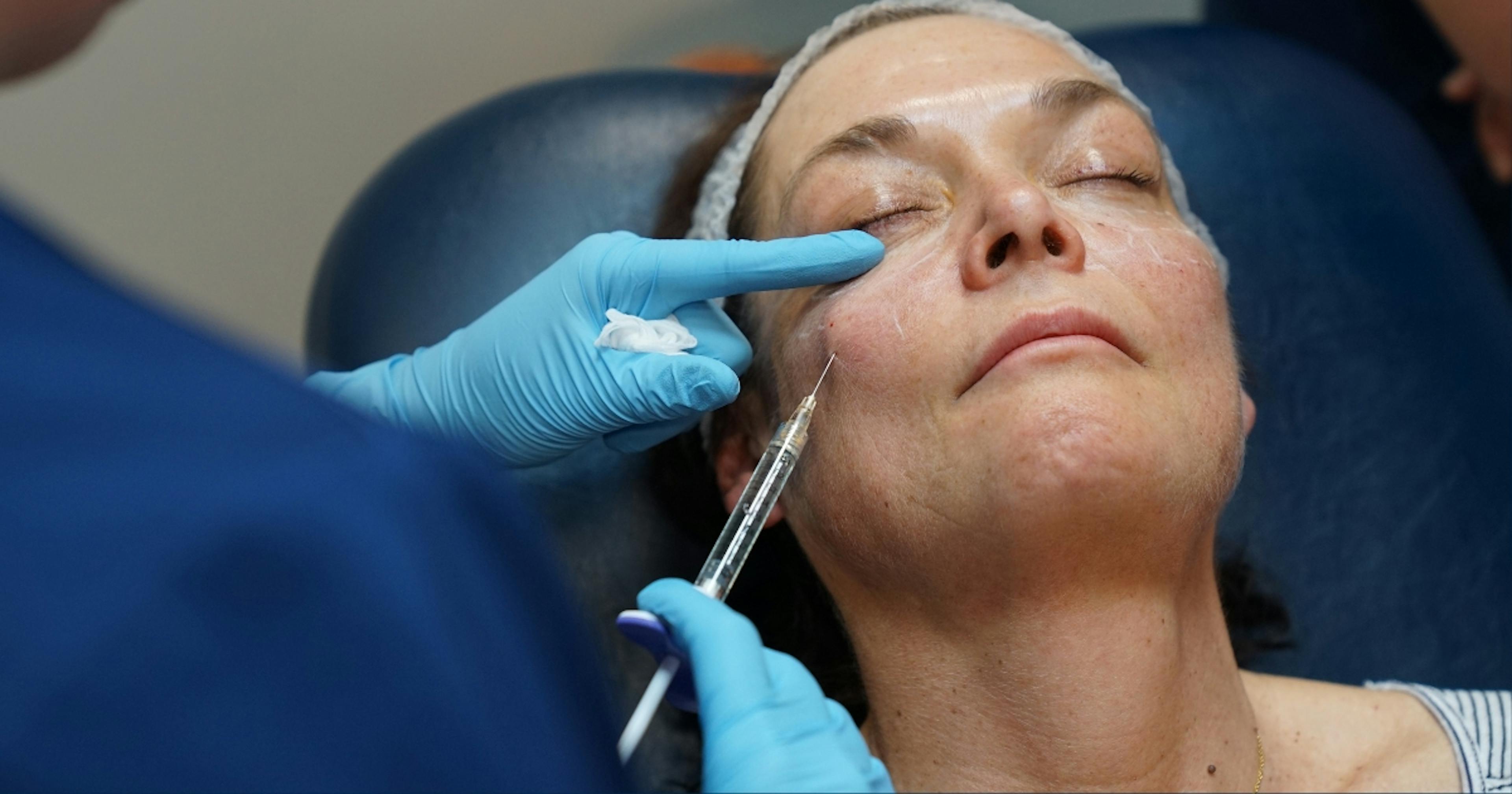 Cheek filler training course session at Harley Academy