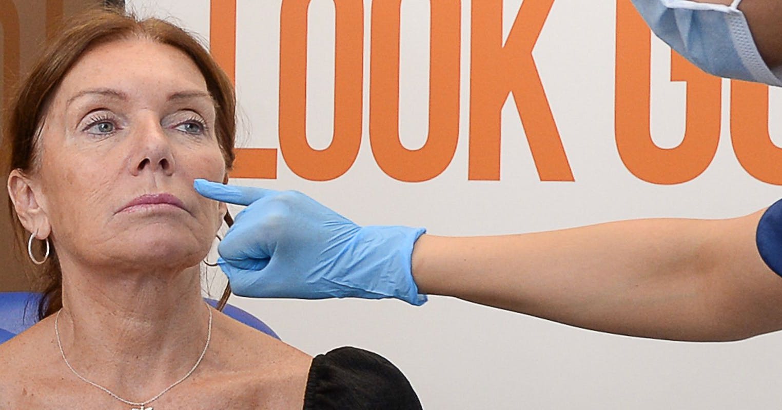 Perioral Rejuvenation treatments and injection techniques