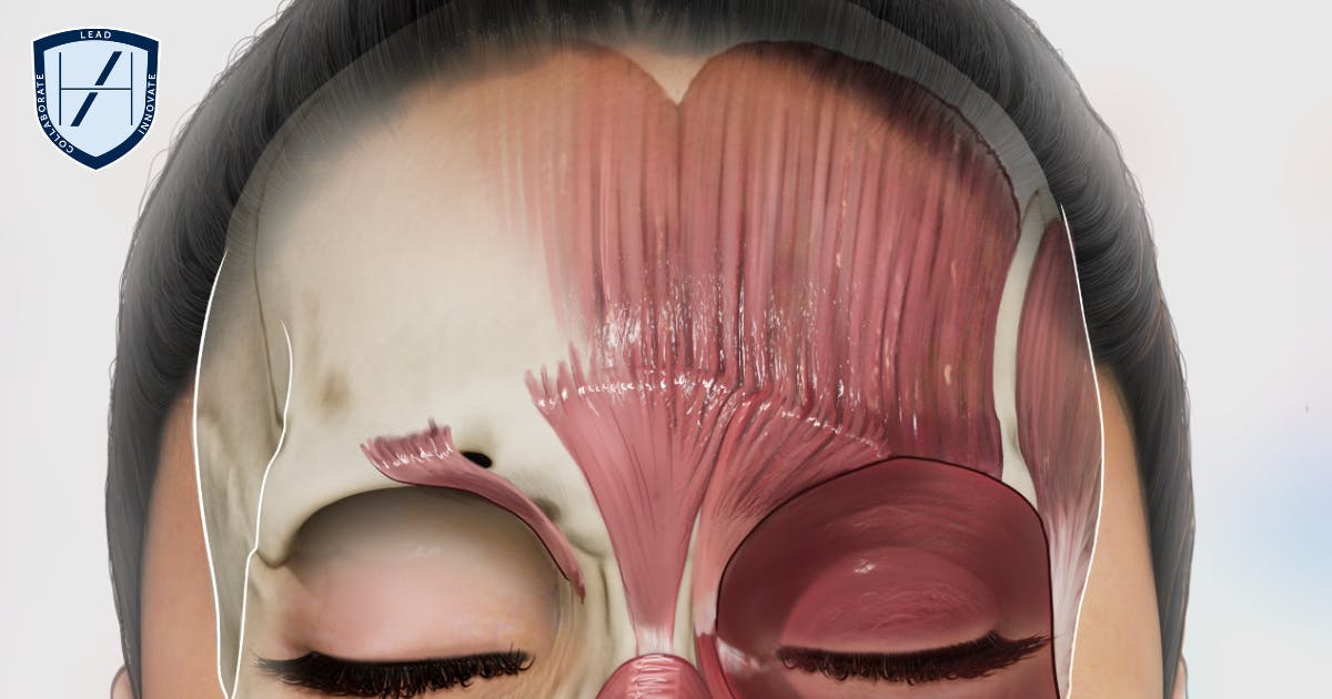 Frontalis and Glabellar Complex facial anatomy aesthetics training diagram Harley Academy