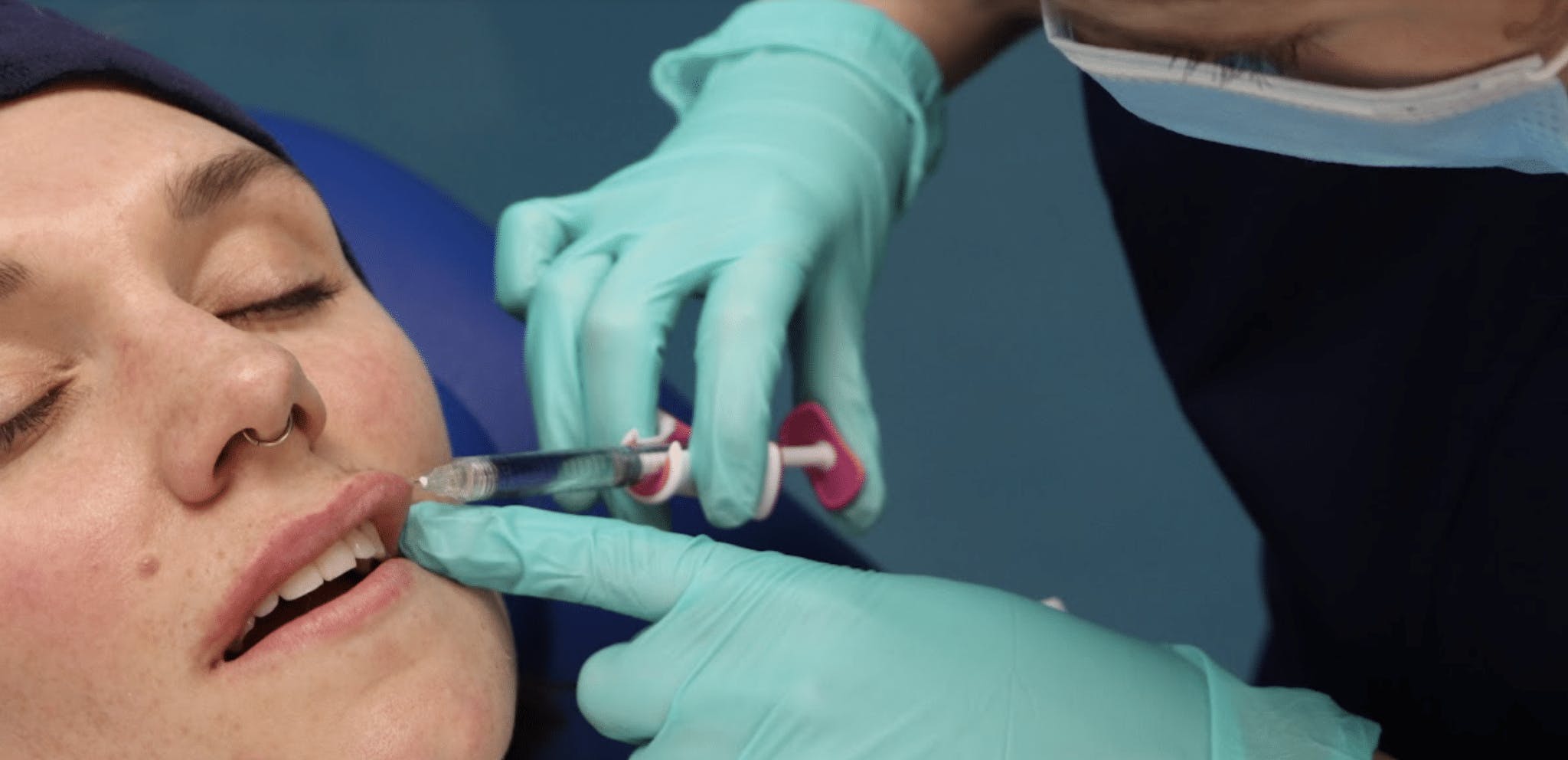 Lip filler 3 Injecting without a Mentor