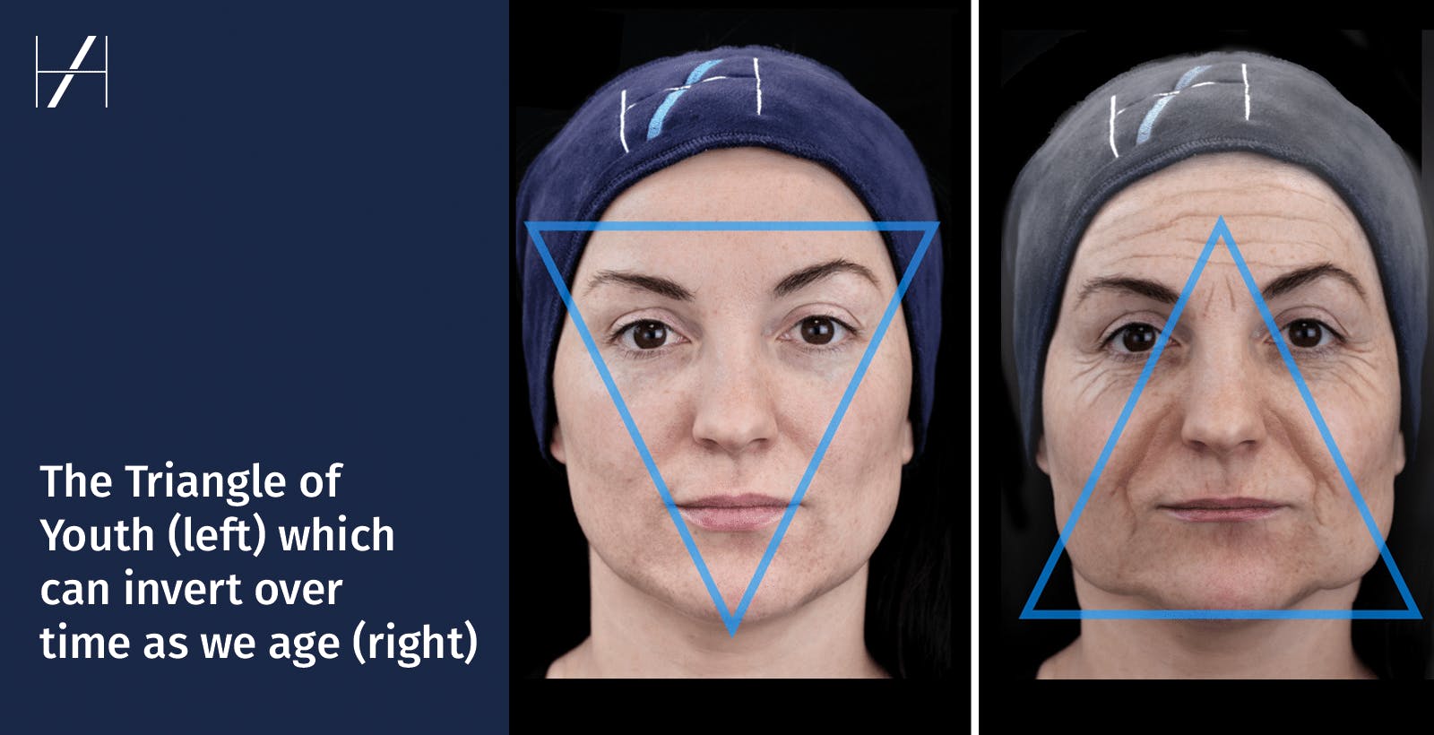 Triangle of Youth aesthetic medicine treatment planning and assessment