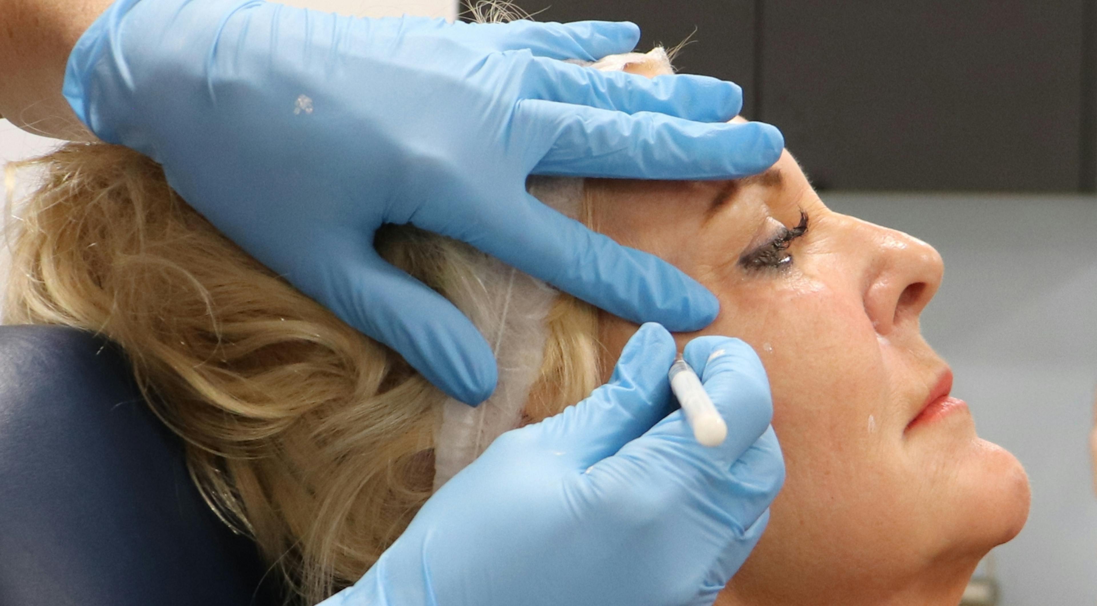 Marking up for cheek filler course at Harley Academy