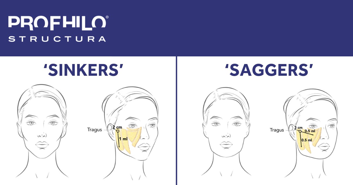 Diagram showing who is suitable for Profhilo Structura regenerative skin injectables