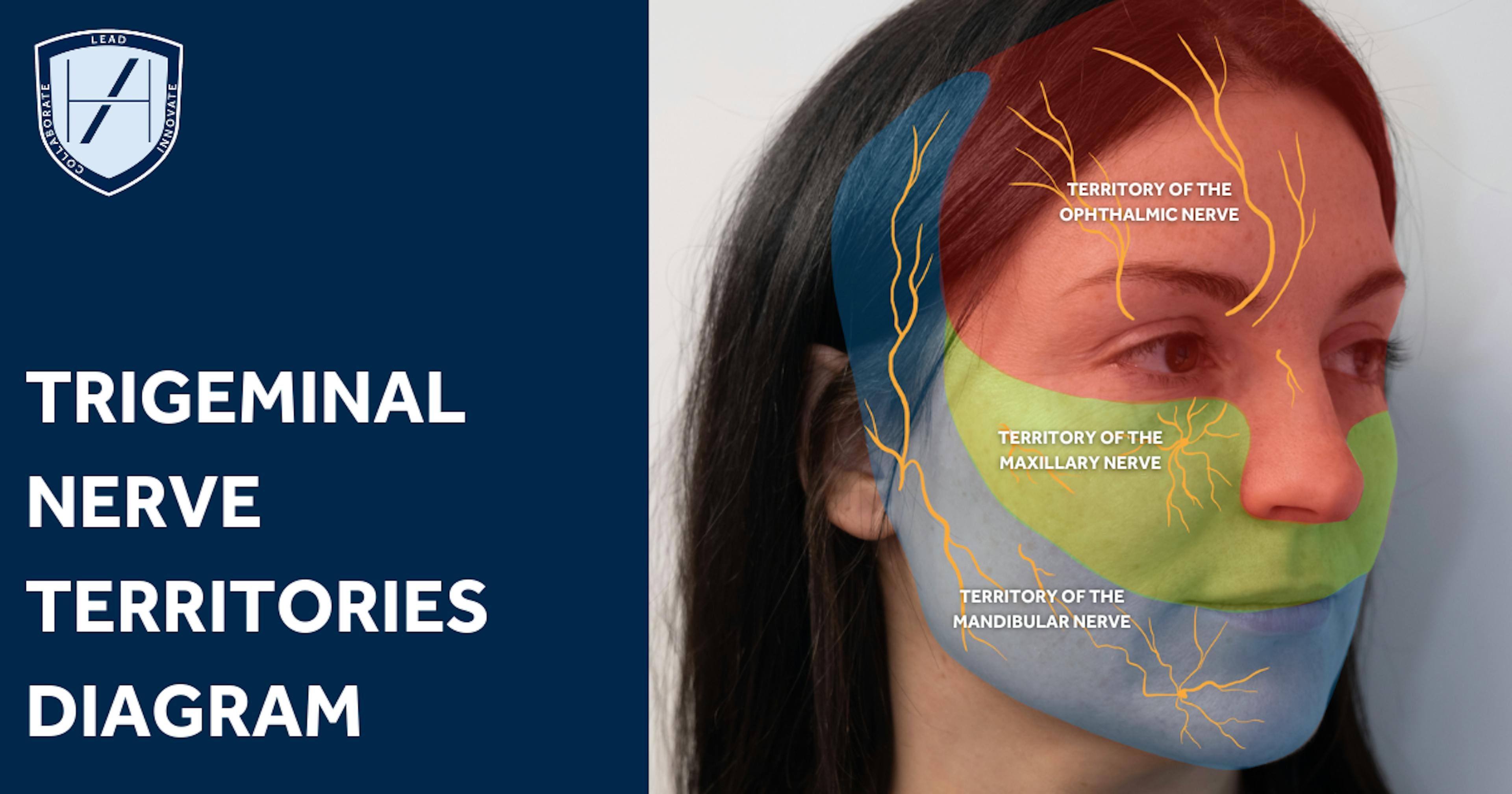 TRIGEMINAL NERVE TERRITORIES diagram for nerve damage after fillers